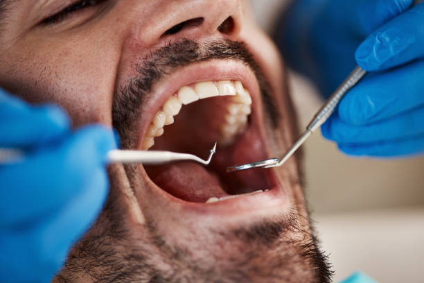 Best Wisdom Tooth Removal  in Brookfield, IL